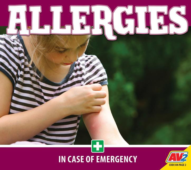 Vorderes Coverbild Allergies