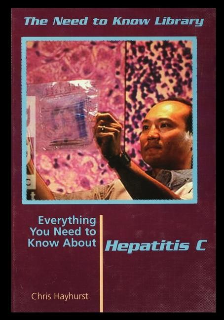 Vorderes Coverbild Hepatitis C