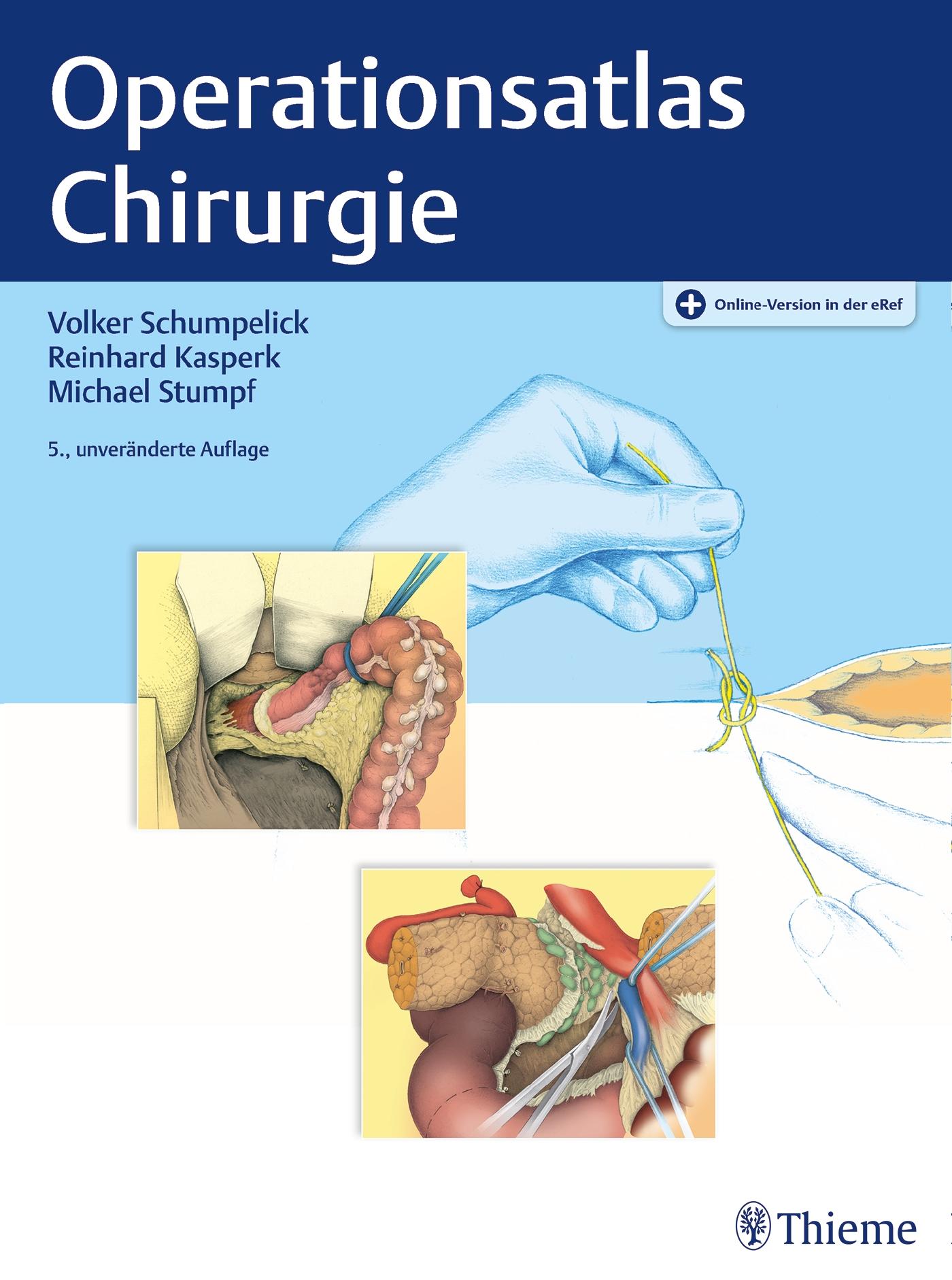 Vorderes Coverbild Operationsatlas Chirurgie
