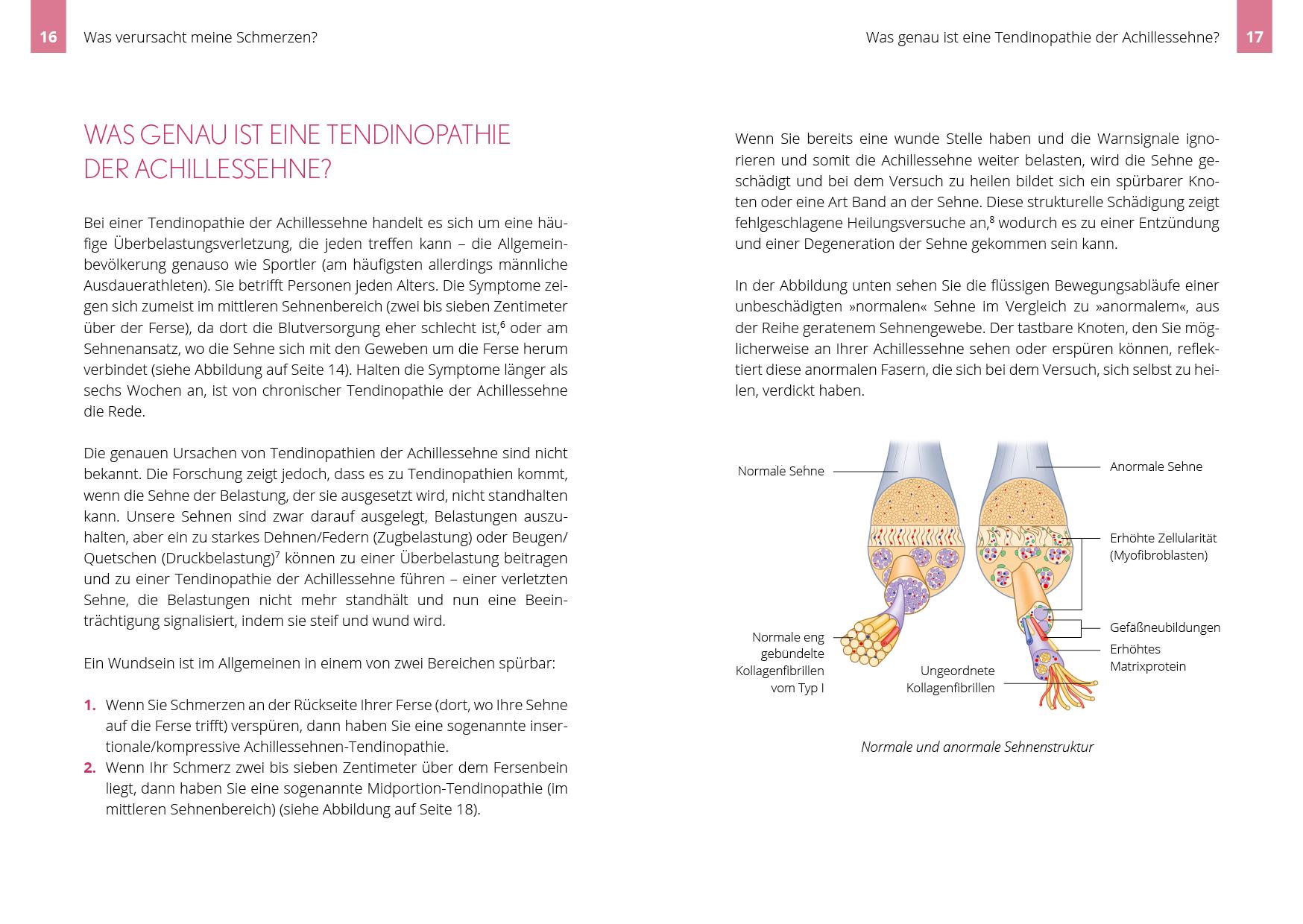Beispielinhalt (Bild) Beschwerden der Achillessehne selbst behandeln