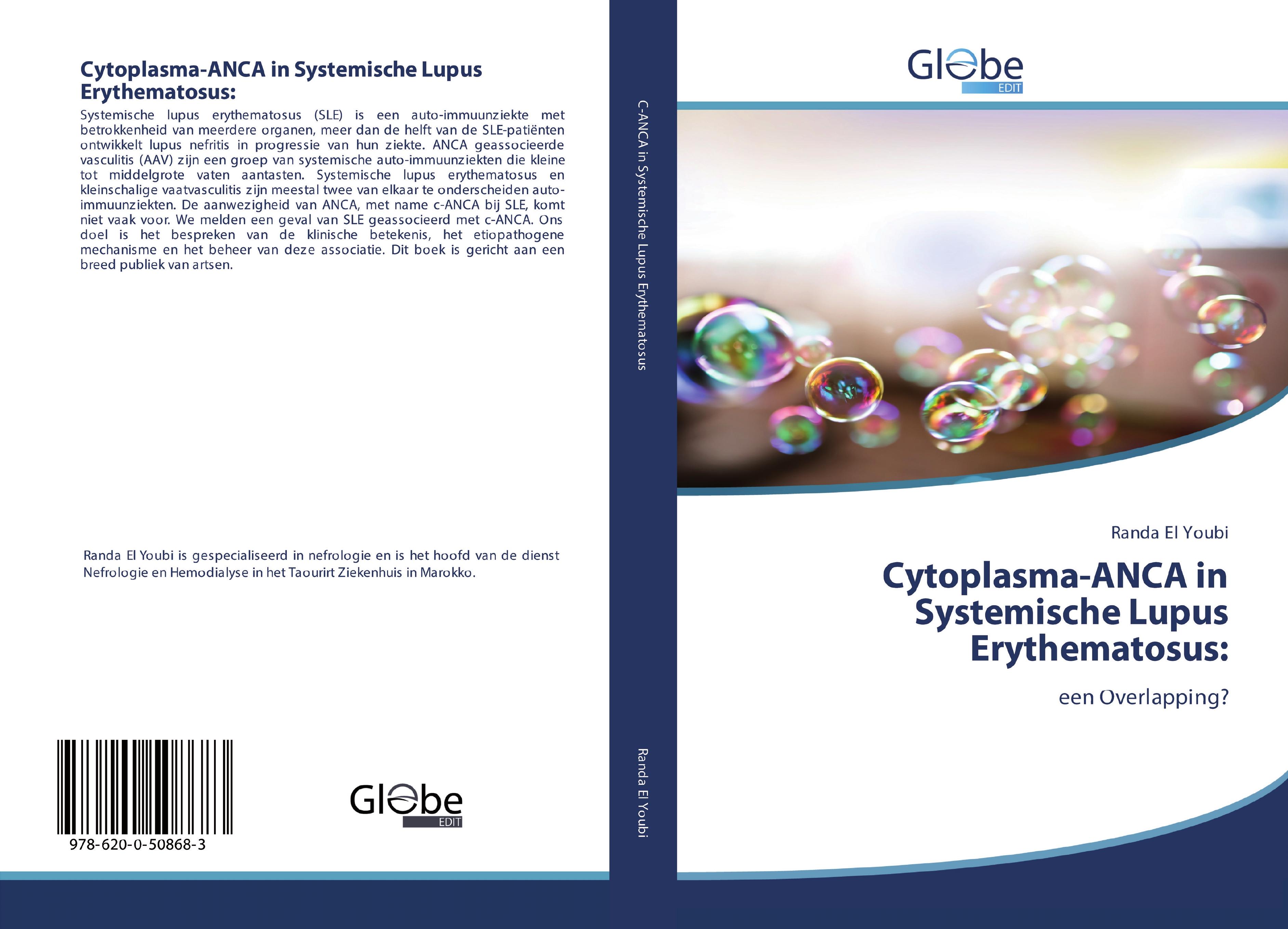 Vorderes Coverbild Cytoplasma-ANCA in Systemische Lupus Erythematosus: