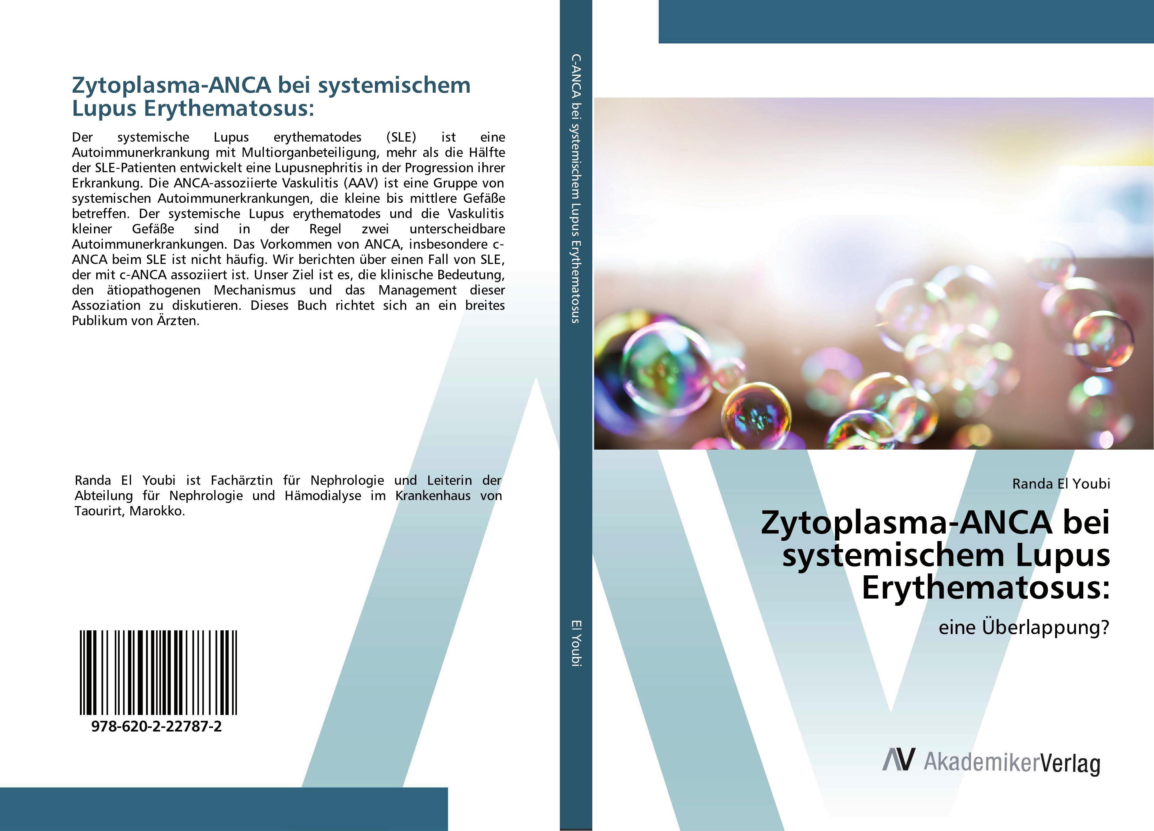 Vorderes Coverbild Zytoplasma-ANCA bei systemischem Lupus Erythematosus: