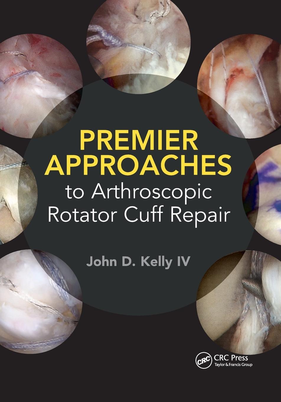 Vorderes Coverbild Premier Approaches to Arthroscopic Rotator Cuff Repair