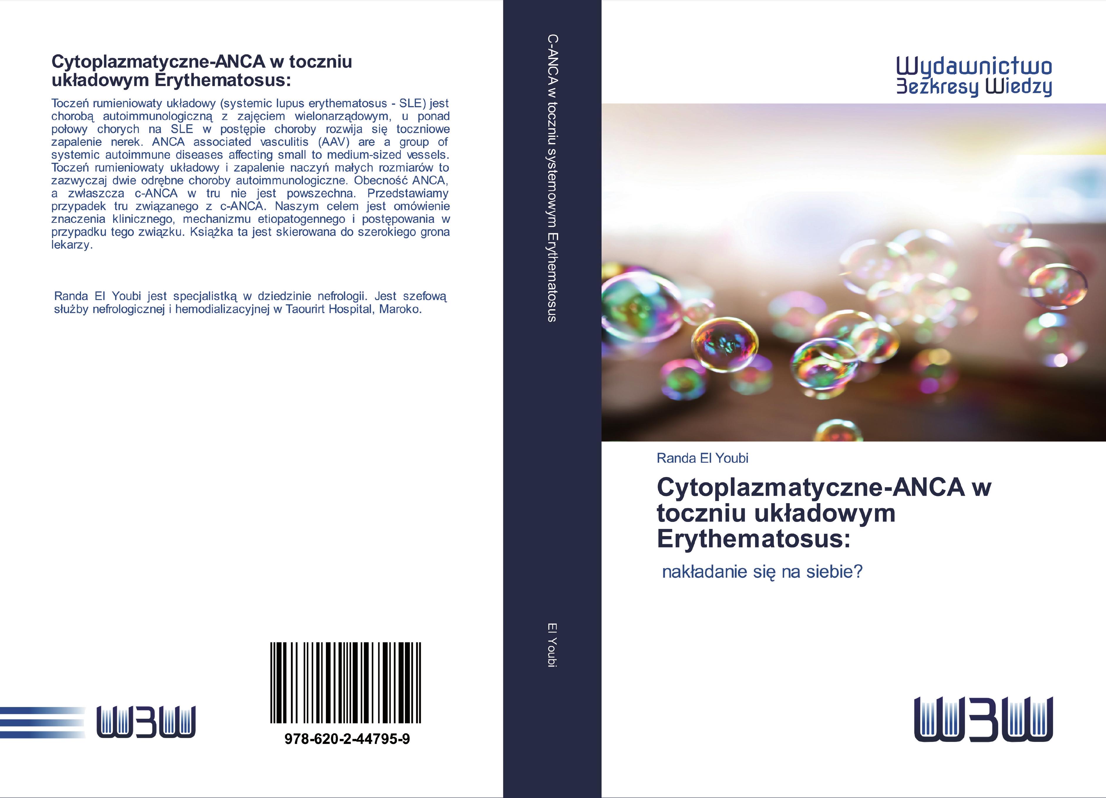 Vorderes Coverbild Cytoplazmatyczne-ANCA w toczniu uk¿adowym Erythematosus: