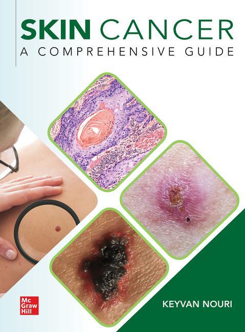 Vorderes Coverbild Skin Cancer: A Comprehensive Guide