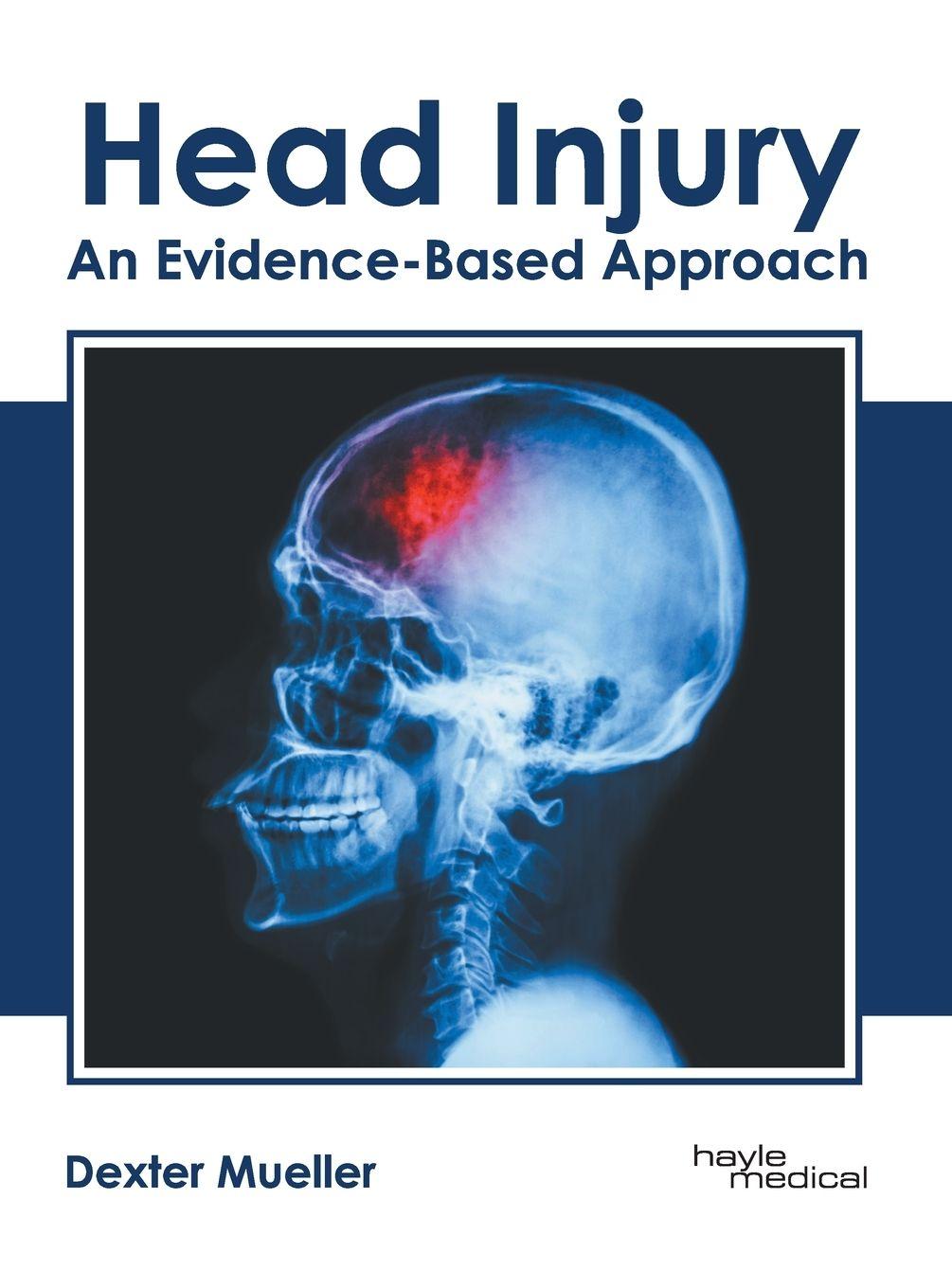 Vorderes Coverbild Head Injury: An Evidence-Based Approach