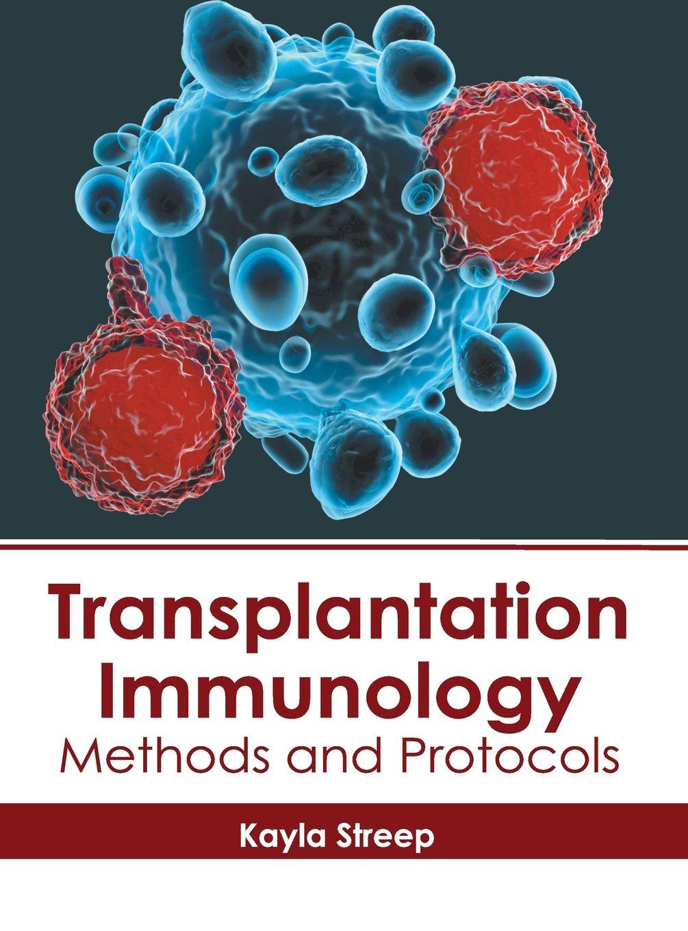 Vorderes Coverbild Transplantation Immunology: Methods and Protocols