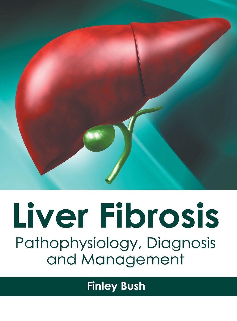 Vorderes Coverbild Liver Fibrosis: Pathophysiology, Diagnosis and Management