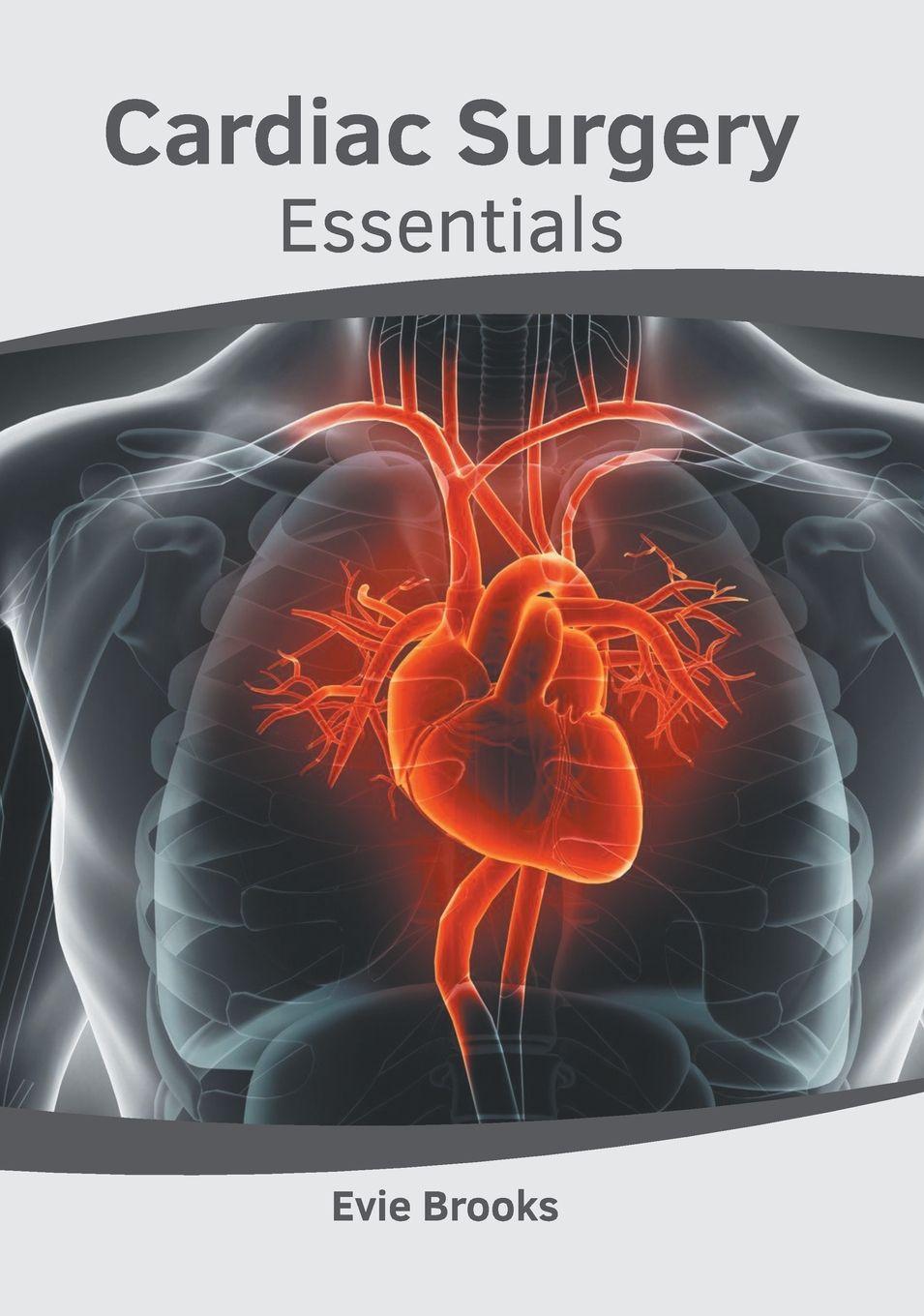 Vorderes Coverbild Cardiac Surgery Essentials