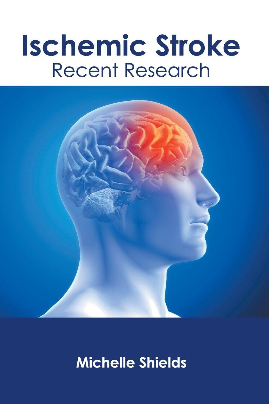 Vorderes Coverbild Ischemic Stroke: Recent Research