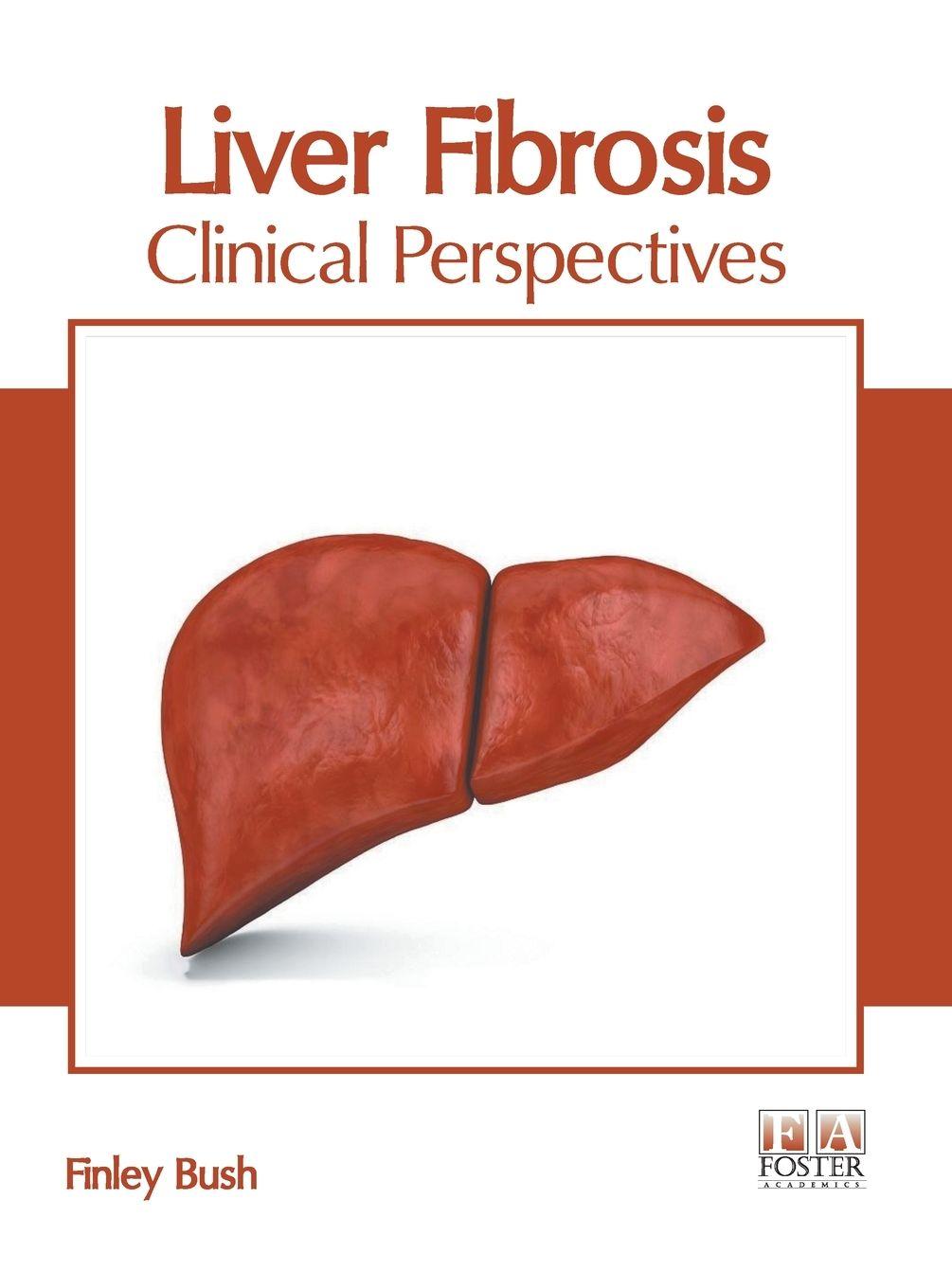 Vorderes Coverbild Liver Fibrosis: Clinical Perspectives