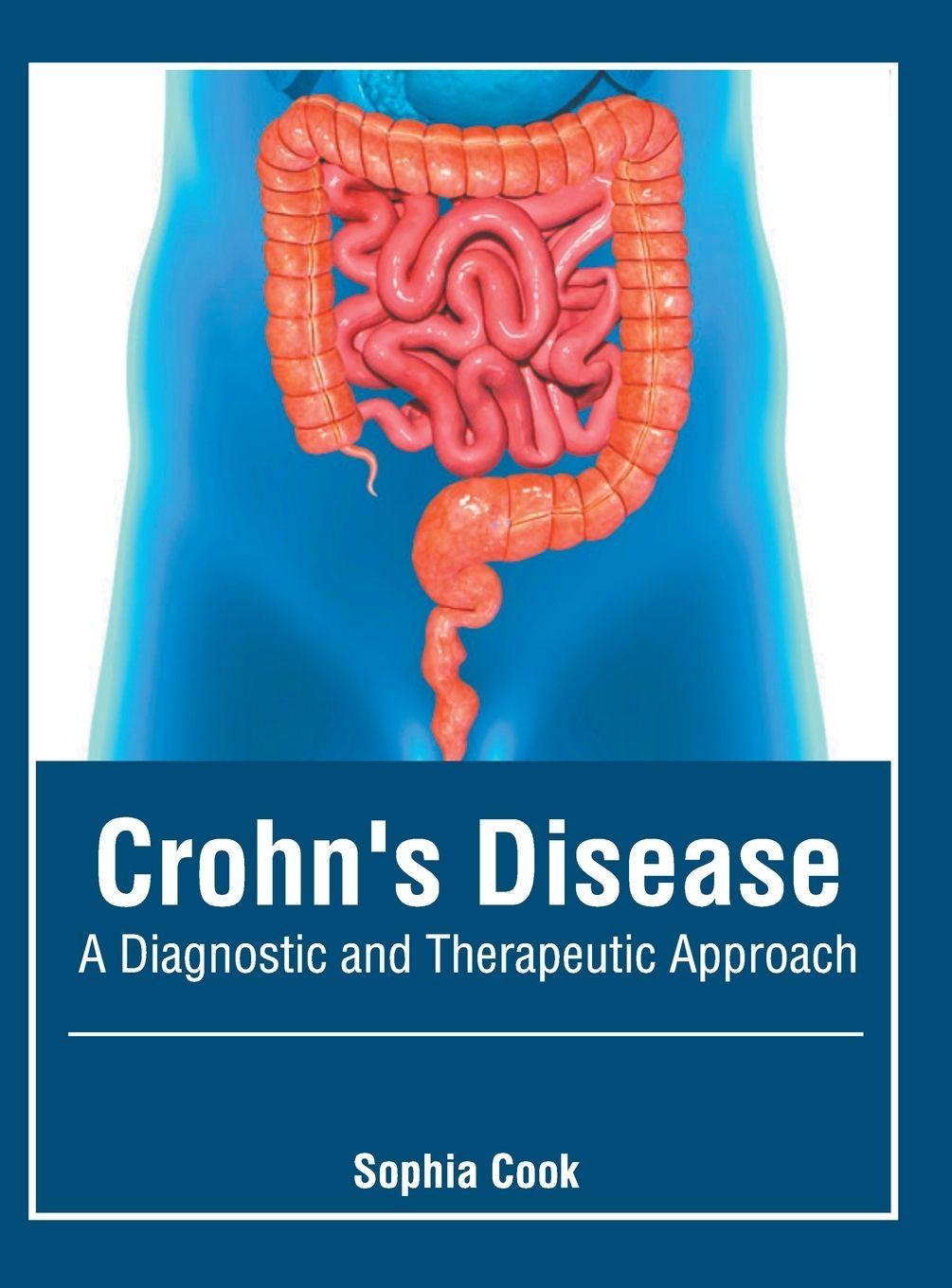 Vorderes Coverbild Crohn's Disease: A Diagnostic and Therapeutic Approach