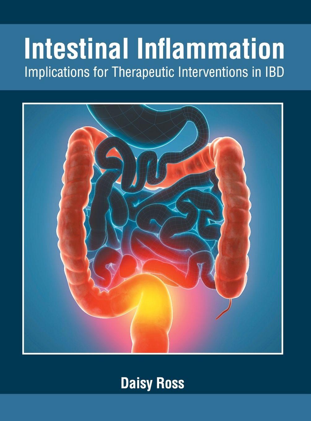 Vorderes Coverbild Intestinal Inflammation: Implications for Therapeutic Interventions in Ibd