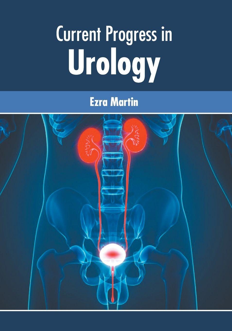 Vorderes Coverbild Current Progress in Urology