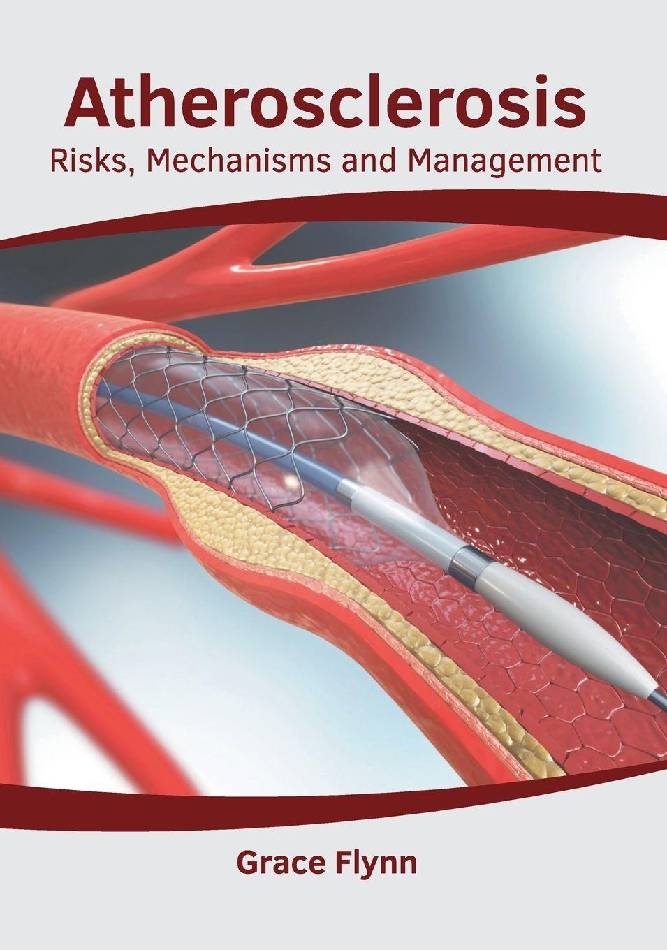 Vorderes Coverbild Atherosclerosis: Risks, Mechanisms and Management