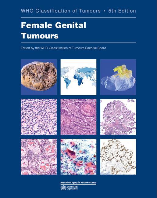 Vorderes Coverbild Female Genital Tumours