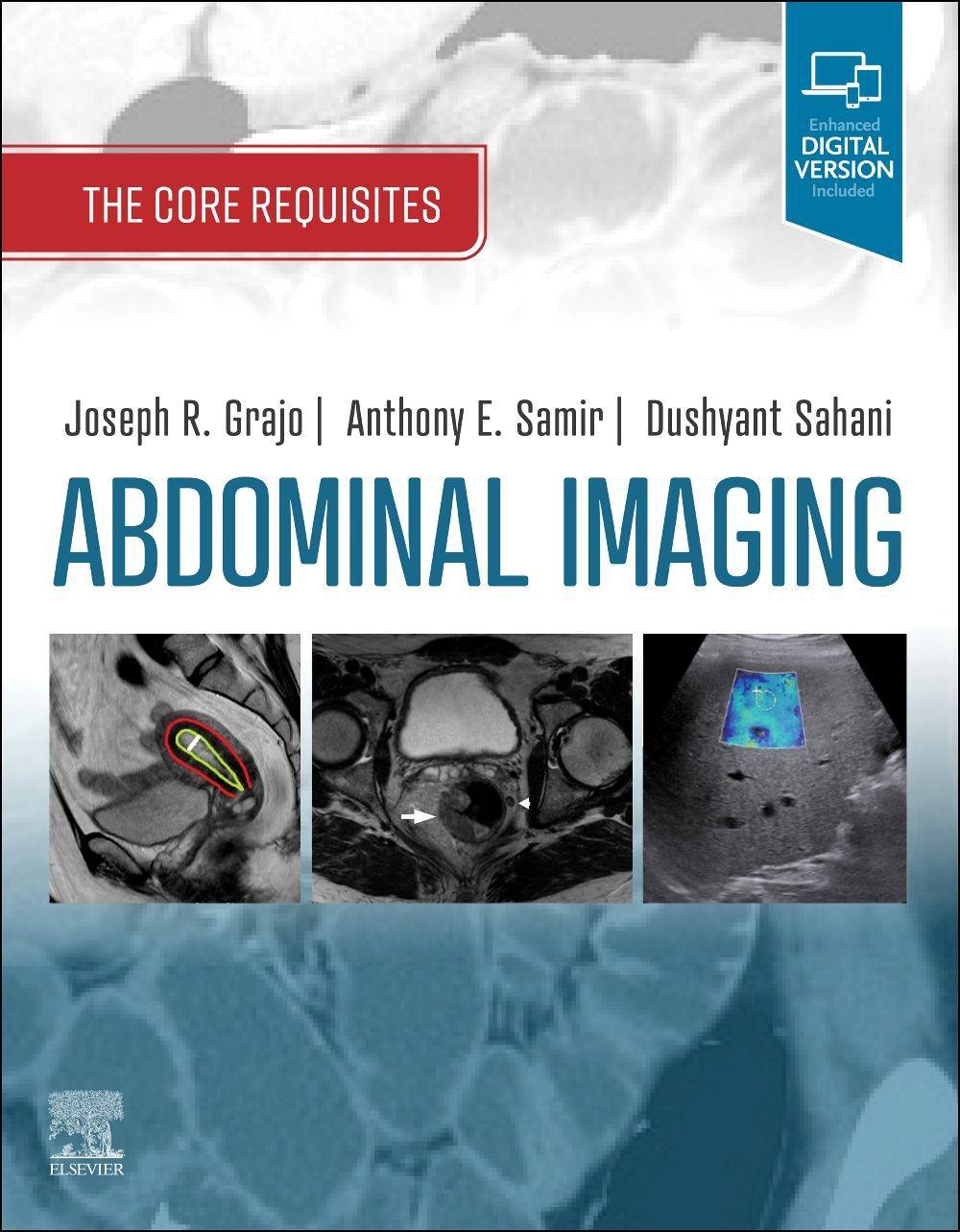 Vorderes Coverbild Abdominal Imaging