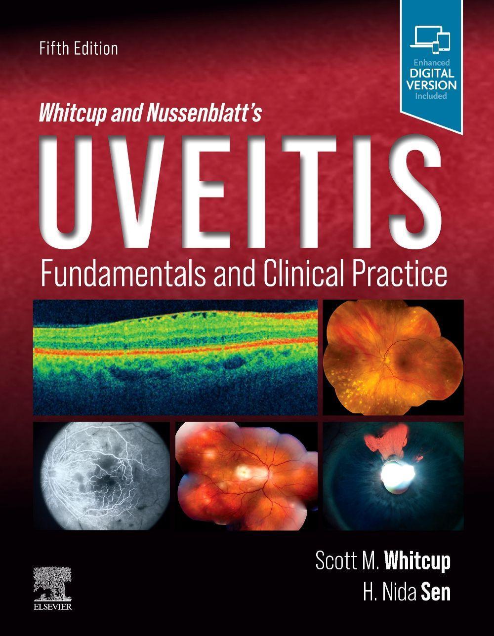 Vorderes Coverbild Whitcup and Nussenblatt's Uveitis