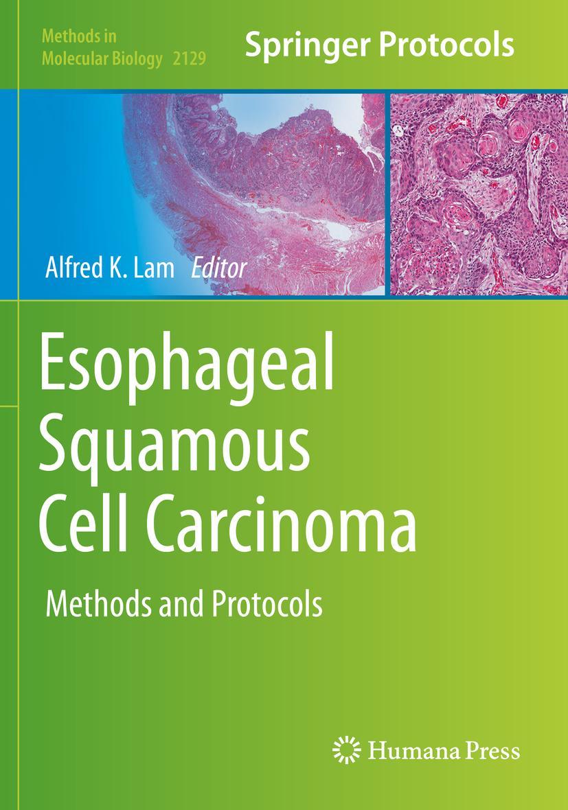 Vorderes Coverbild Esophageal Squamous Cell Carcinoma