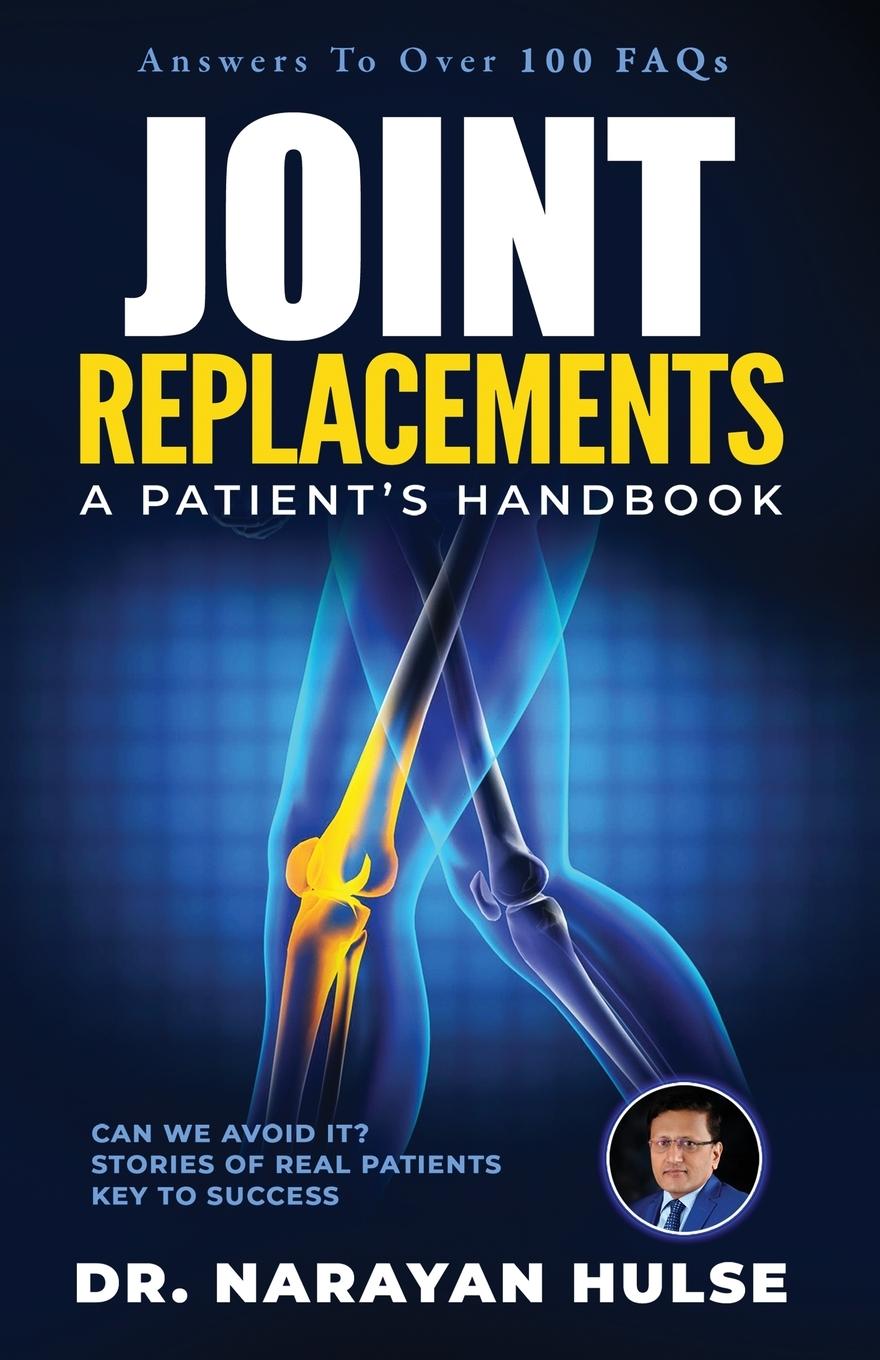 Vorderes Coverbild Joint Replacements