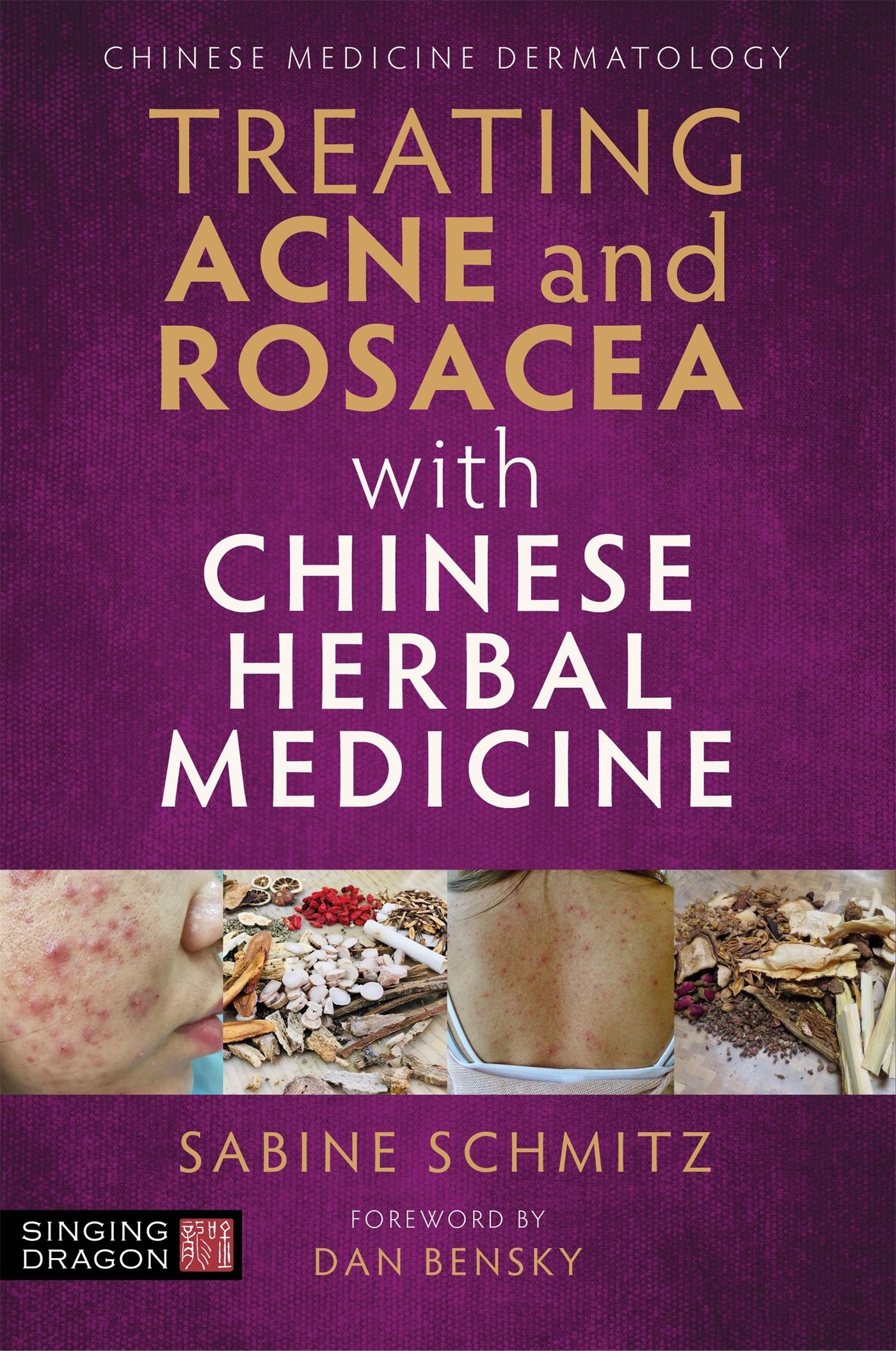Vorderes Coverbild Treating Acne and Rosacea with Chinese Herbal Medicine