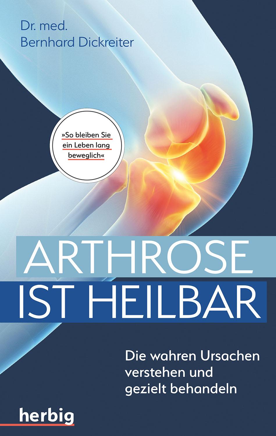 Vorderes Coverbild Arthrose ist heilbar