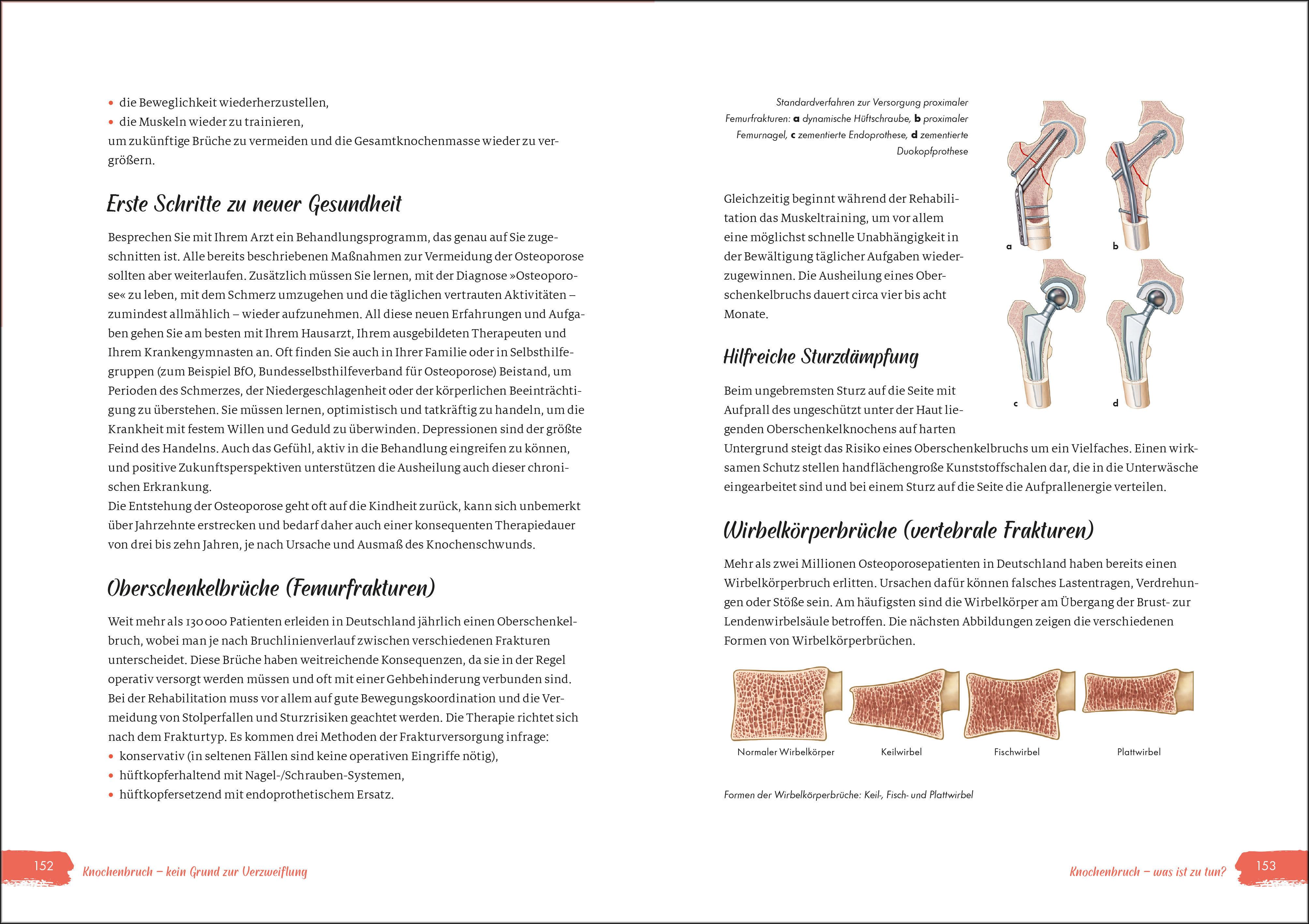 Beispielinhalt (Bild) Power für die Knochen  - Osteoporose vorbeugen, diagnostizieren, behandeln - Übungsteil von Johanna Fellner