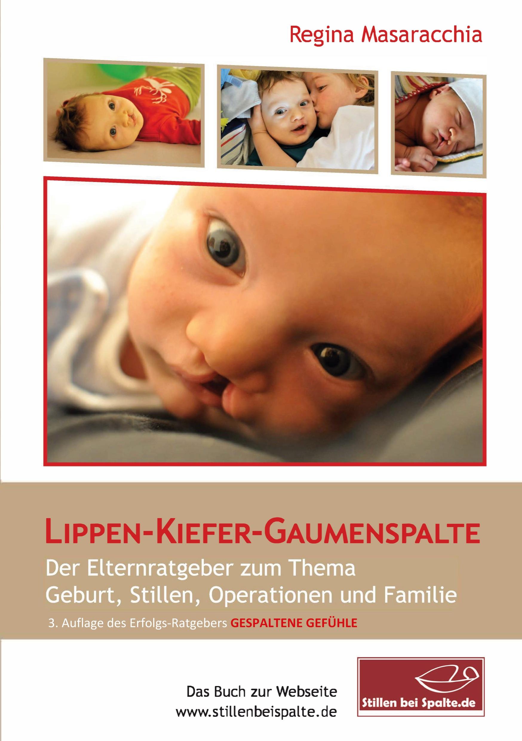 Vorderes Coverbild Lippen-Kiefer-Gaumenspalte