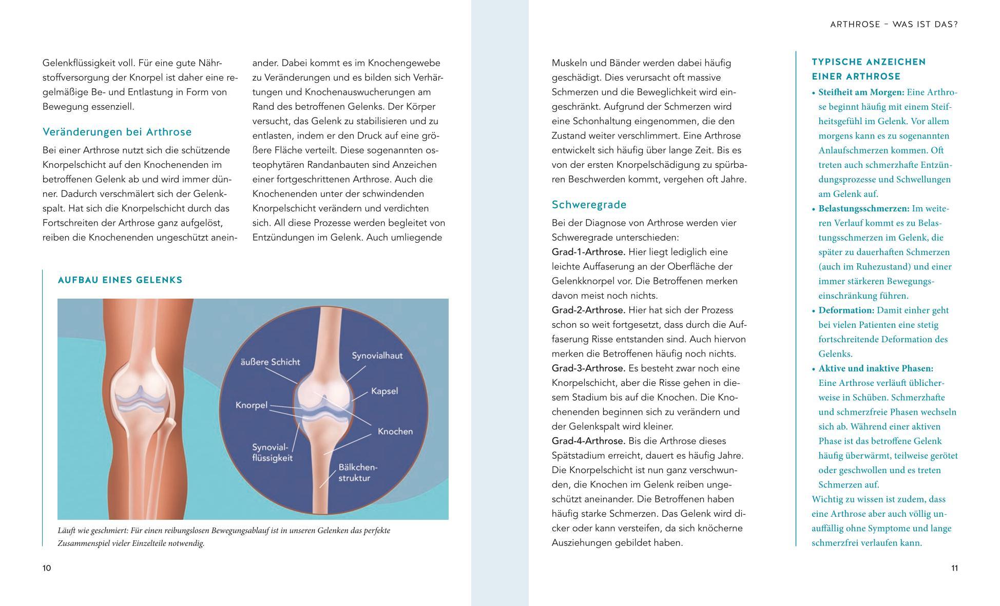 Beispielinhalt (Bild) Schmerzfrei bei Arthrose