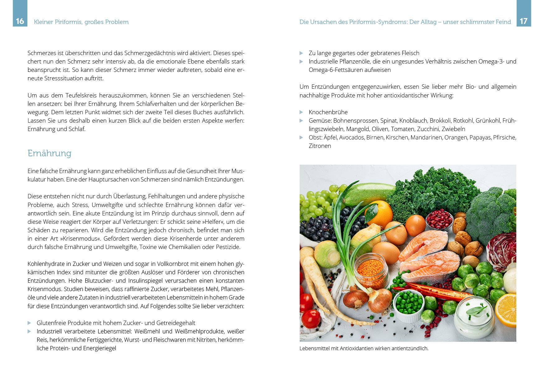 Beispielinhalt (Bild) Ischiasbeschwerden und das Piriformis-Syndrom