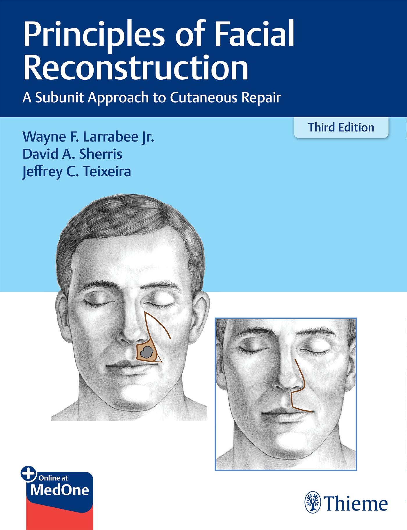 Vorderes Coverbild Principles of Facial Reconstruction