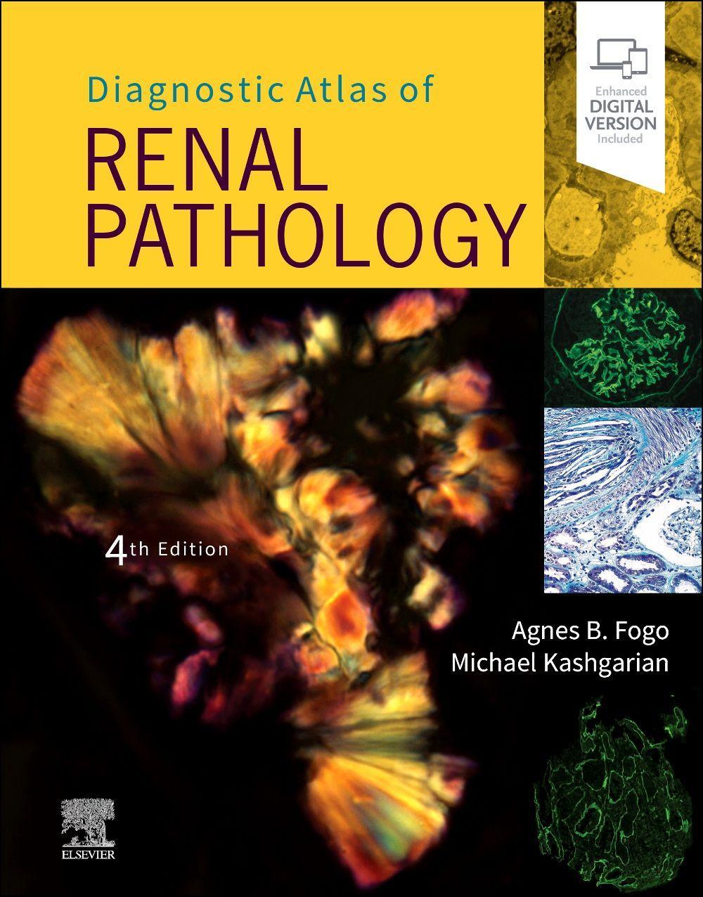 Vorderes Coverbild Diagnostic Atlas of Renal Pathology