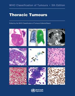 Vorderes Coverbild Thoracic Tumours