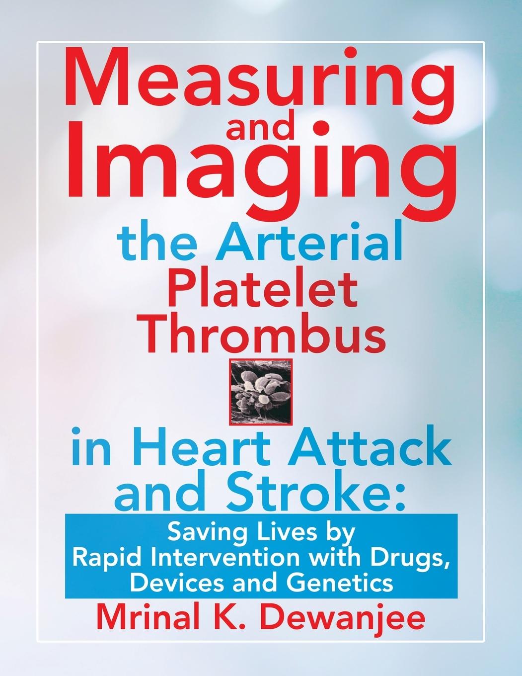 Vorderes Coverbild Measuring and Imaging the Arterial Platelet Thrombus in Heart Attack and Stroke