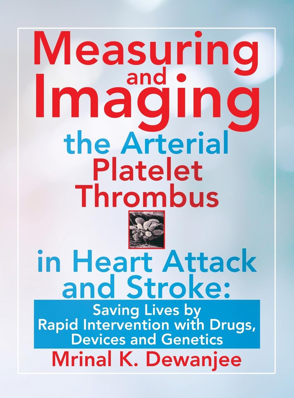 Vorderes Coverbild Measuring and Imaging the Arterial Platelet Thrombus in Heart Attack and Stroke