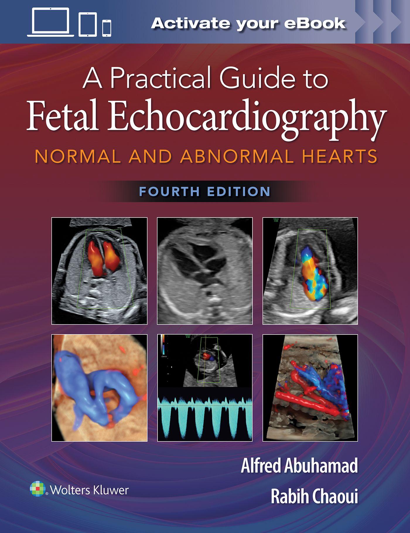 Vorderes Coverbild A Practical Guide to Fetal Echocardiography