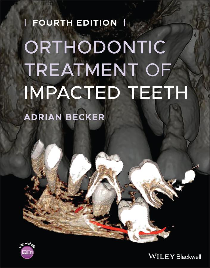 Vorderes Coverbild Orthodontic Treatment of Impacted Teeth