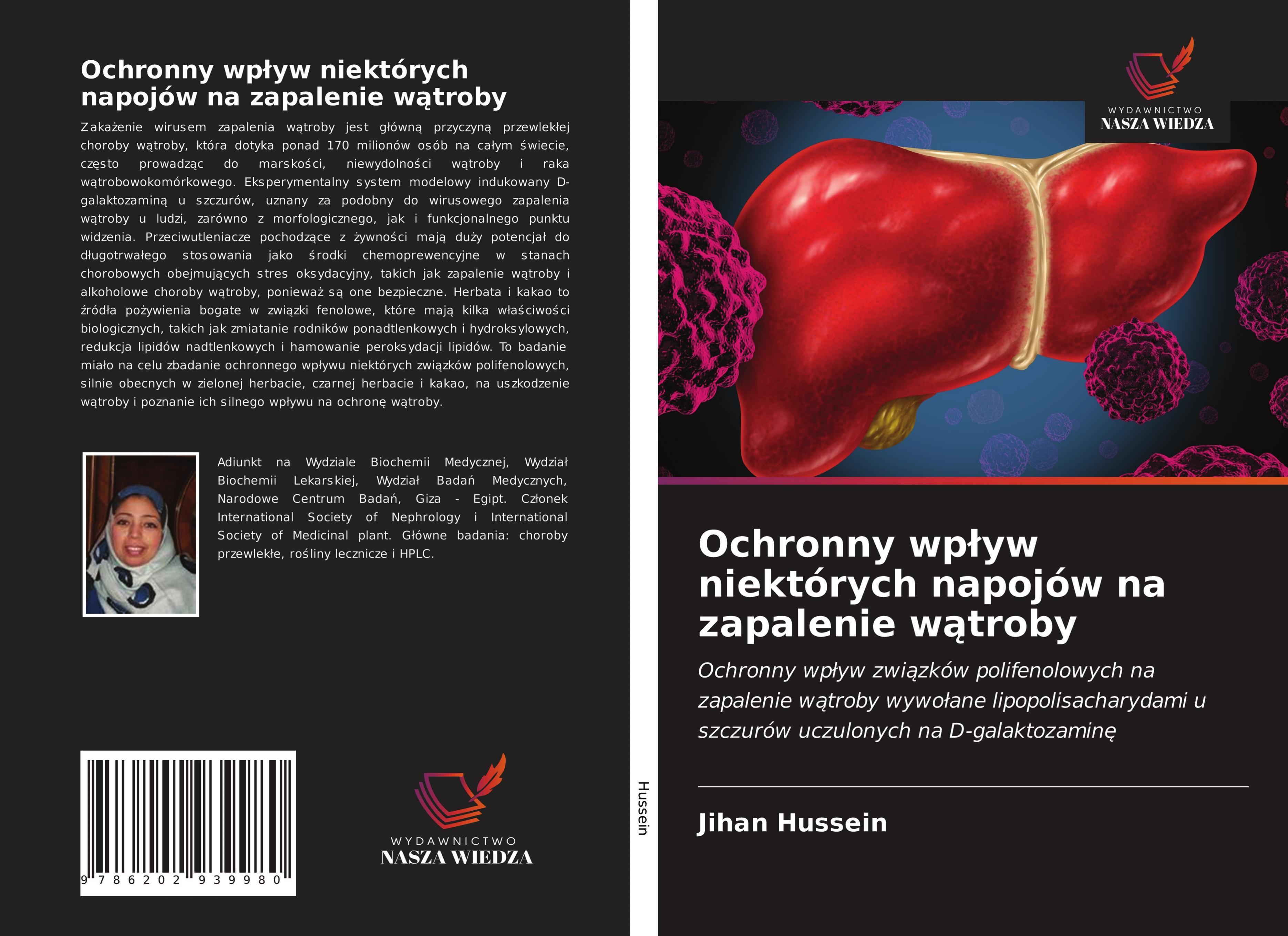 Vorderes Coverbild Ochronny wp¿yw niektórych napojów na zapalenie w¿troby