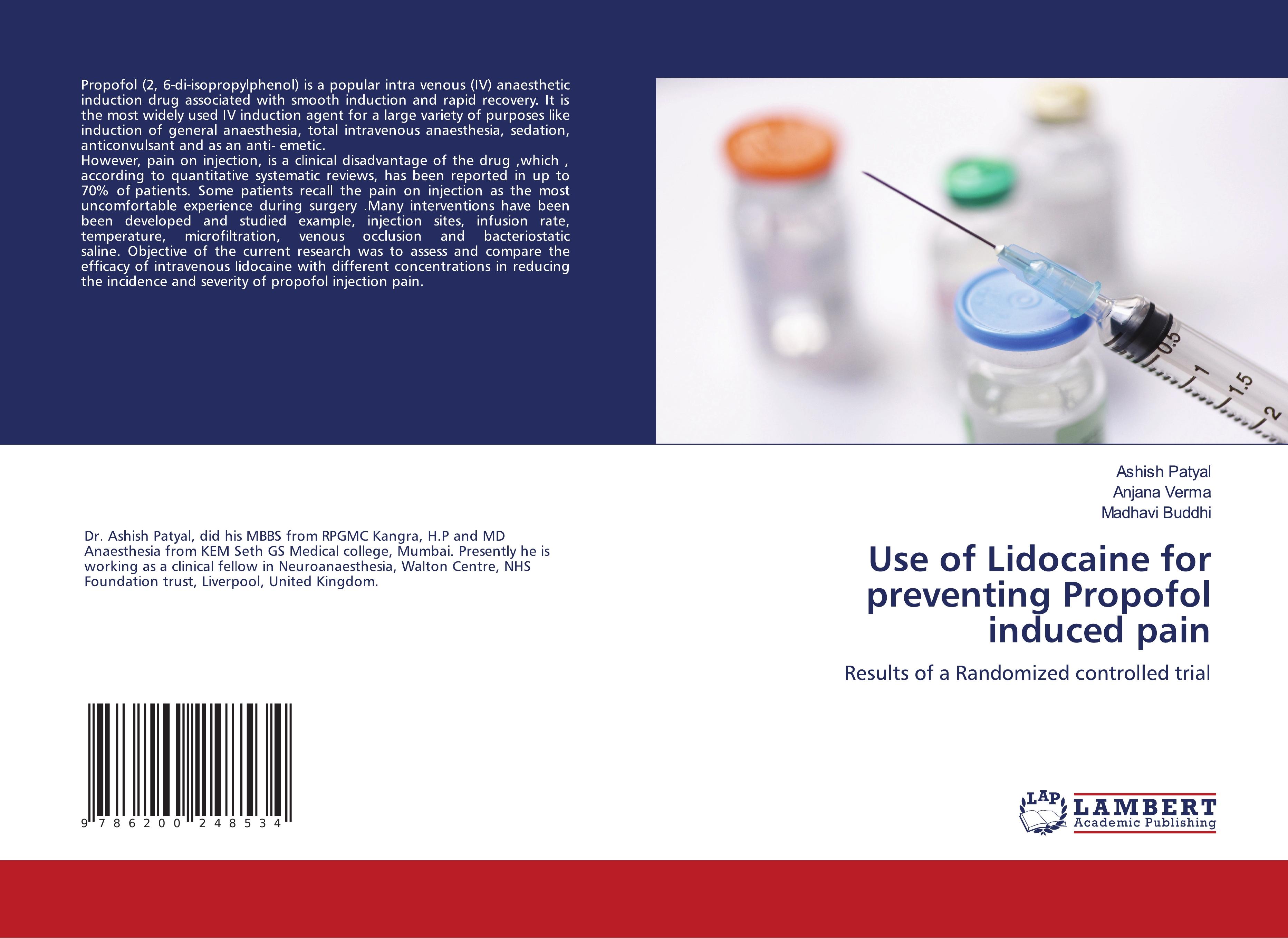 Vorderes Coverbild Use of Lidocaine for preventing Propofol induced pain