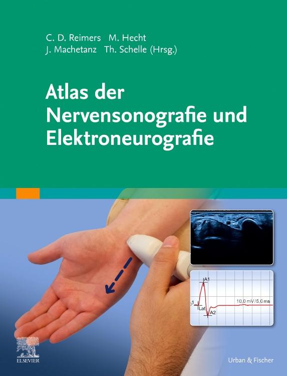 Vorderes Coverbild Atlas der Nervensonografie und Elektroneurografie