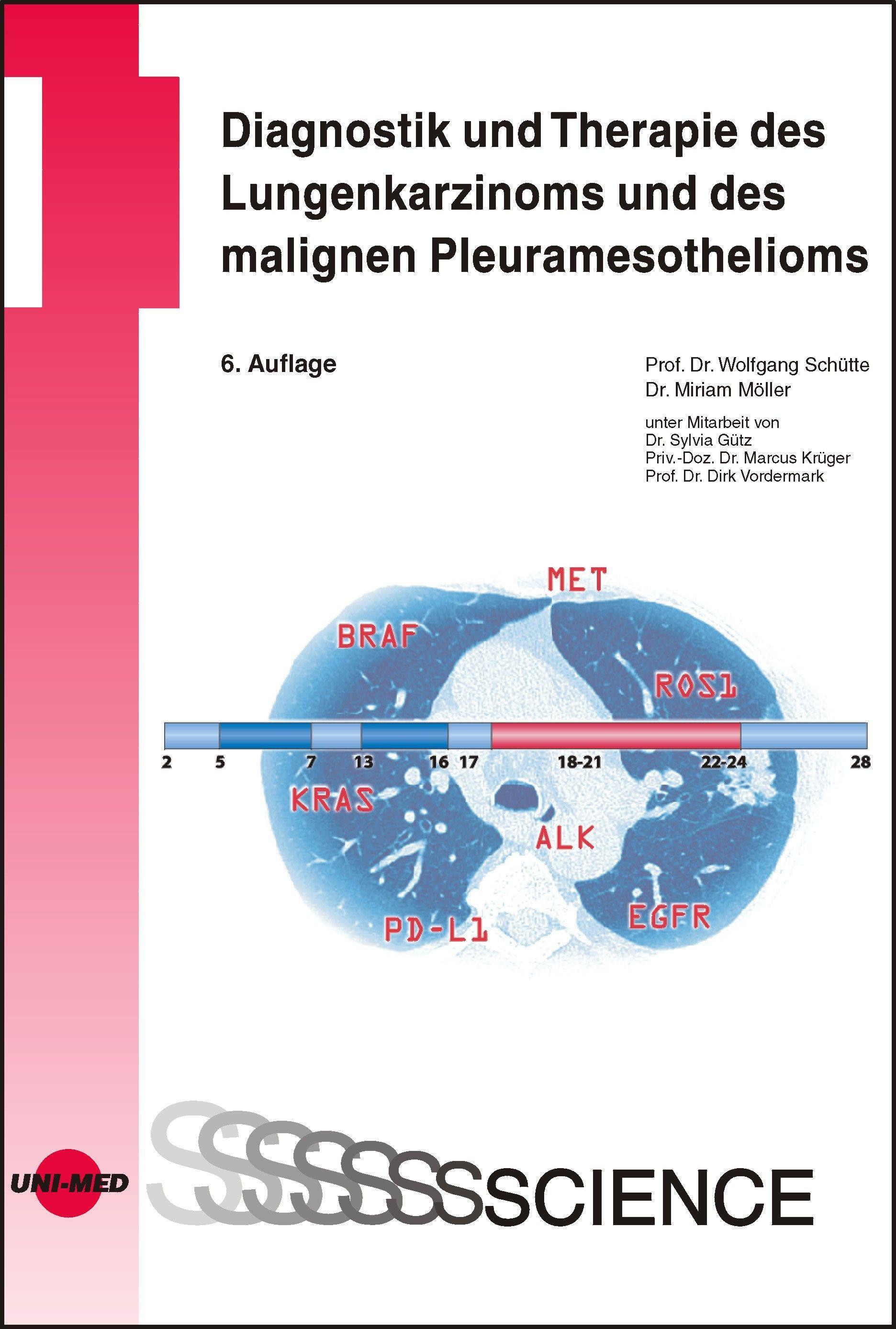 Vorderes Coverbild Diagnostik und Therapie des Lungenkarzinoms und des malignen Pleuramesothelioms