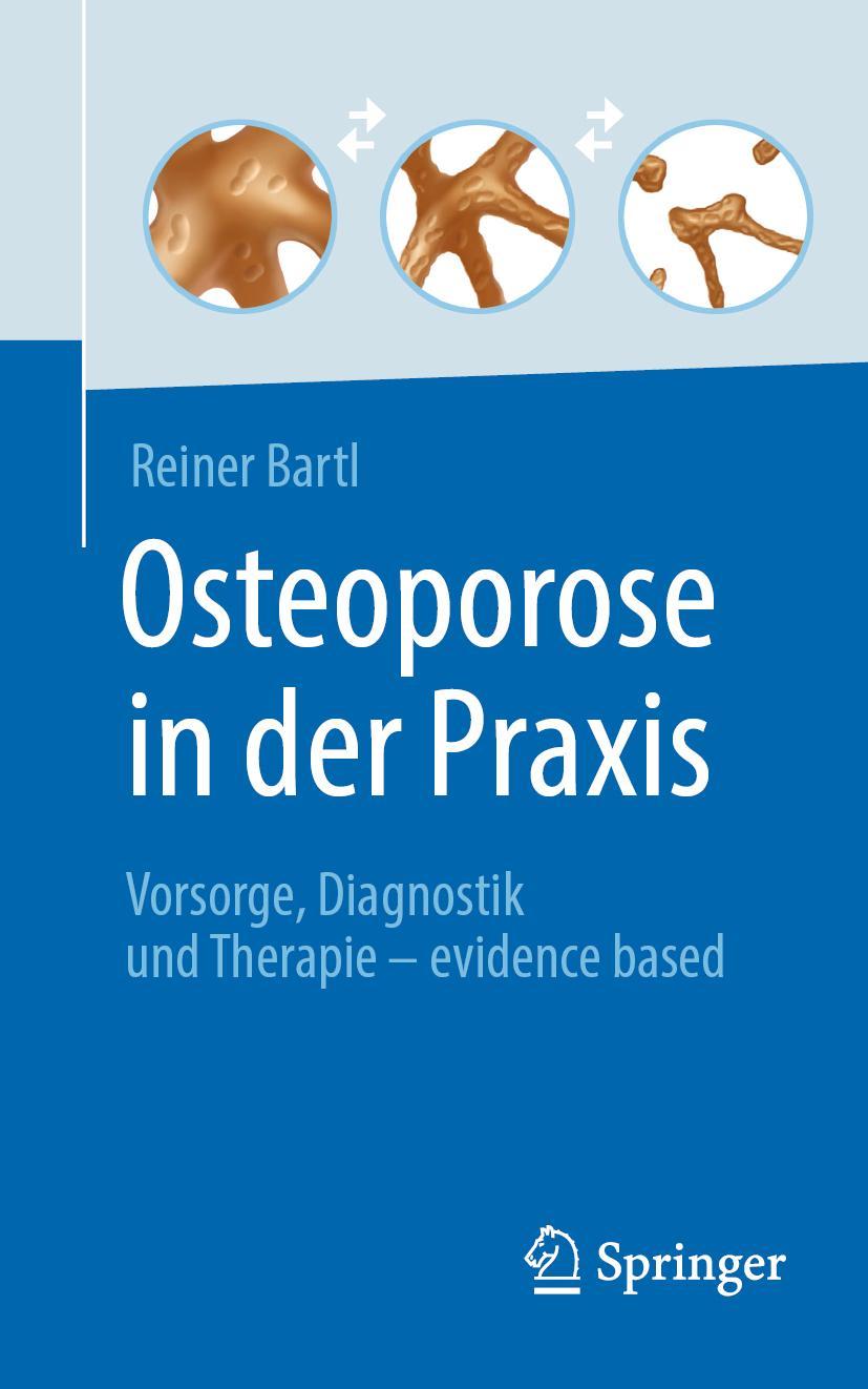 Vorderes Coverbild Osteoporose in der Praxis