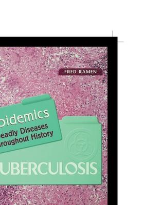 Vorderes Coverbild Tuberculosis