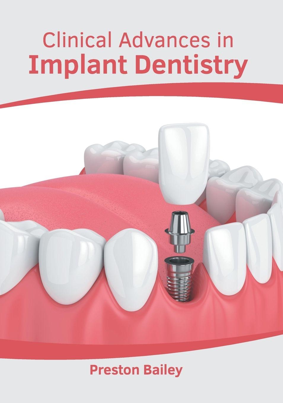 Vorderes Coverbild Clinical Advances in Implant Dentistry