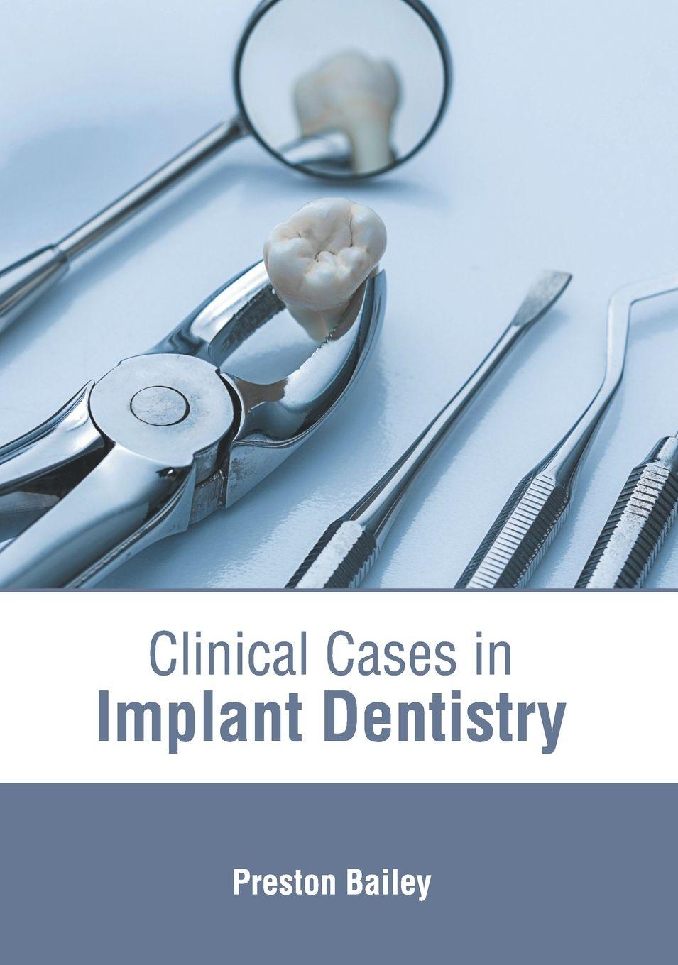 Vorderes Coverbild Clinical Cases in Implant Dentistry