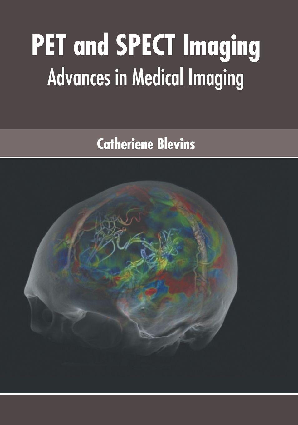 Vorderes Coverbild Pet and Spect Imaging: Advances in Medical Imaging