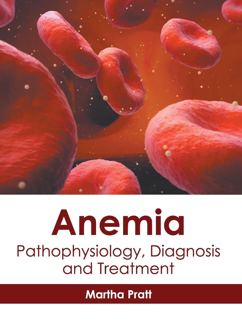 Vorderes Coverbild Anemia: Pathophysiology, Diagnosis and Treatment
