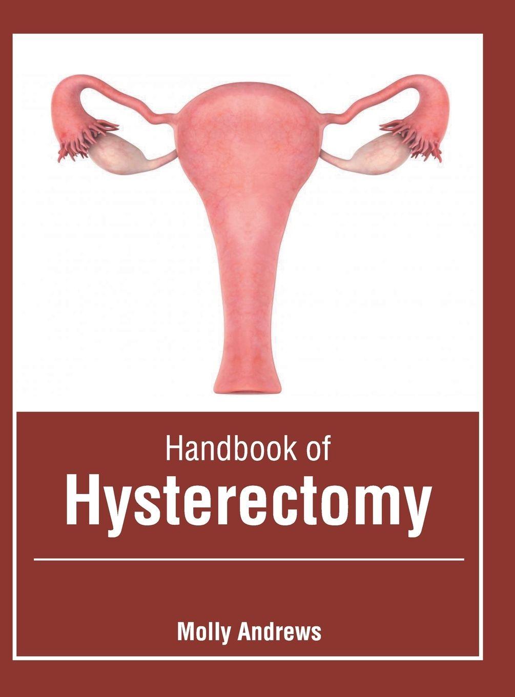 Vorderes Coverbild Handbook of Hysterectomy