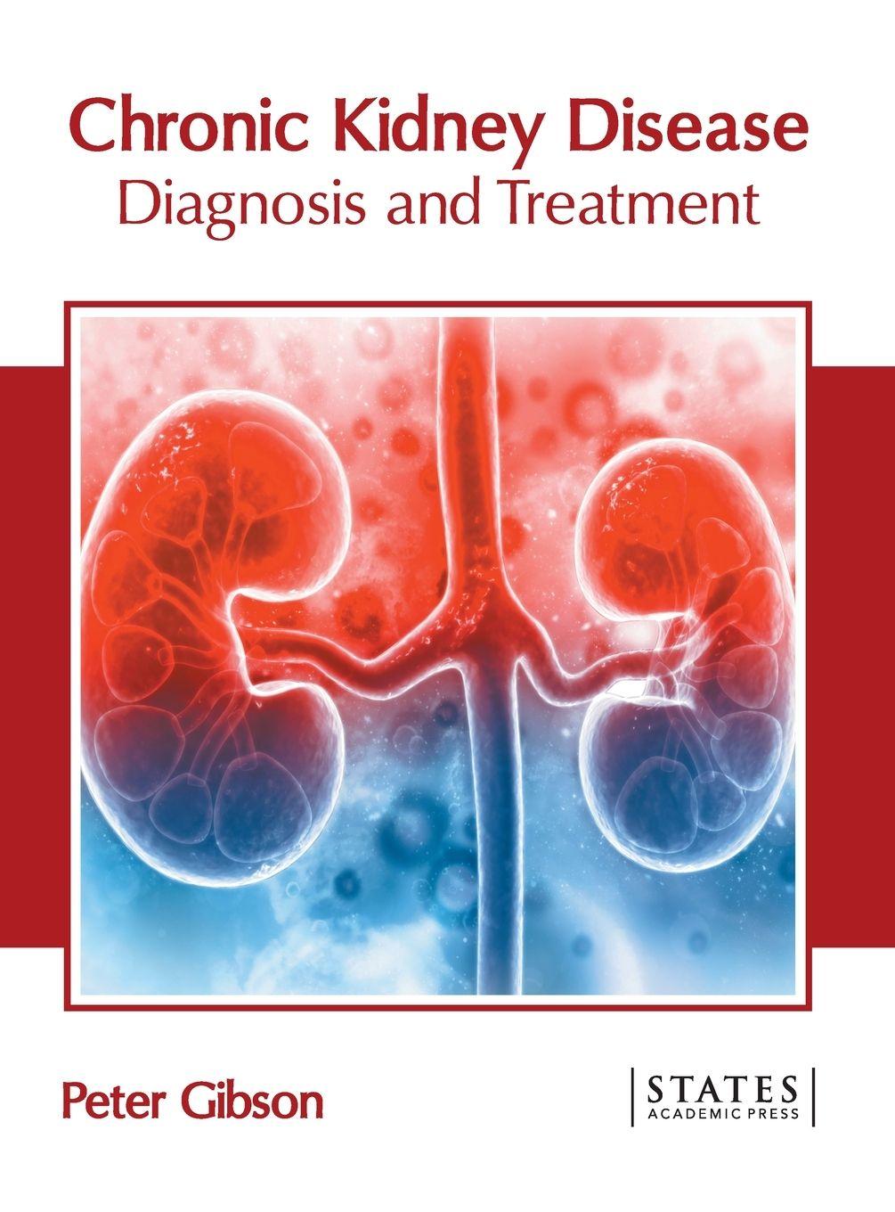 Vorderes Coverbild Chronic Kidney Disease: Diagnosis and Treatment
