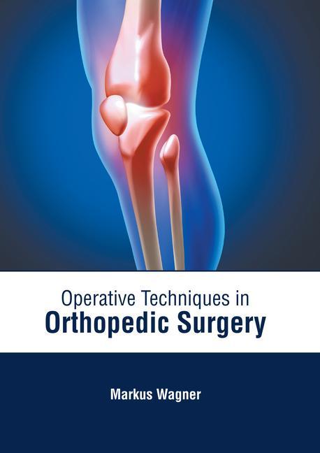 Vorderes Coverbild Operative Techniques in Orthopedic Surgery